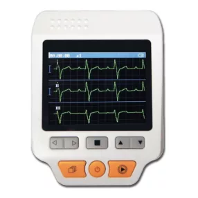 Hordozható kisméretű EKG készülék