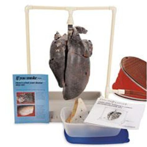 Normál és dohányos tüdő