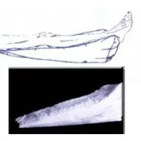 Gyopár s2l lábszár támasz 44 cm x 22 cm x 22 cm